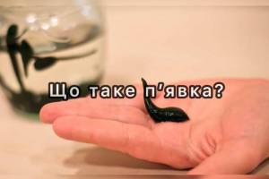 Що таке п’явка?