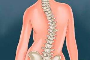 При дитячому сколіозі допоможе методика Сергійчука